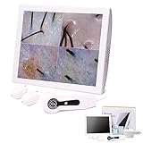 KEhtu Haarfollikel-Detektor, 15-Zoll-Großbild-Kopfhautdetektor...