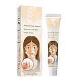 OIXEY 1 Stück Aufhellende Creme, Natürliche Pflanzenextrakte, Mildert Sanft Und Wirksam Weiße...