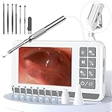 Ohrenschmalz Entferner Otoskop, VITCOCO 3,9mm Otoskop Mit 4.3-Zoll HD IPS- Bildschirm, Ohrenreiniger...
