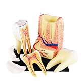 AMITD 4D Dental Teeth Model, 23 Detachable Parts, for Medical Education