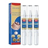 HELVES Wipe Off Tags & Mole Remover Fast Easy Effective, Wipeoff Tags & Moles Remover, Wipe Off Skin...
